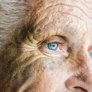 Senior woman with glaucoma