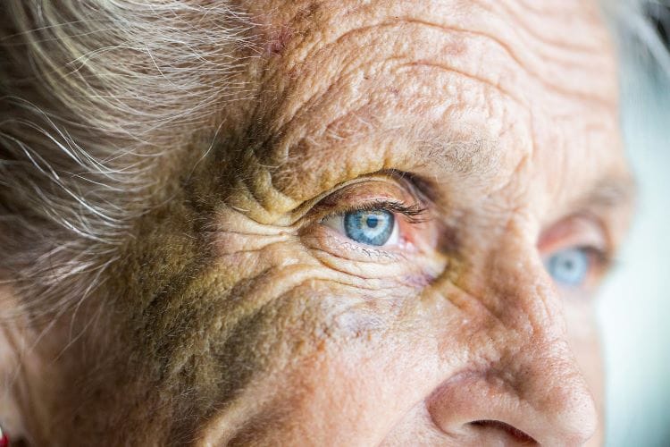 Senior woman with glaucoma